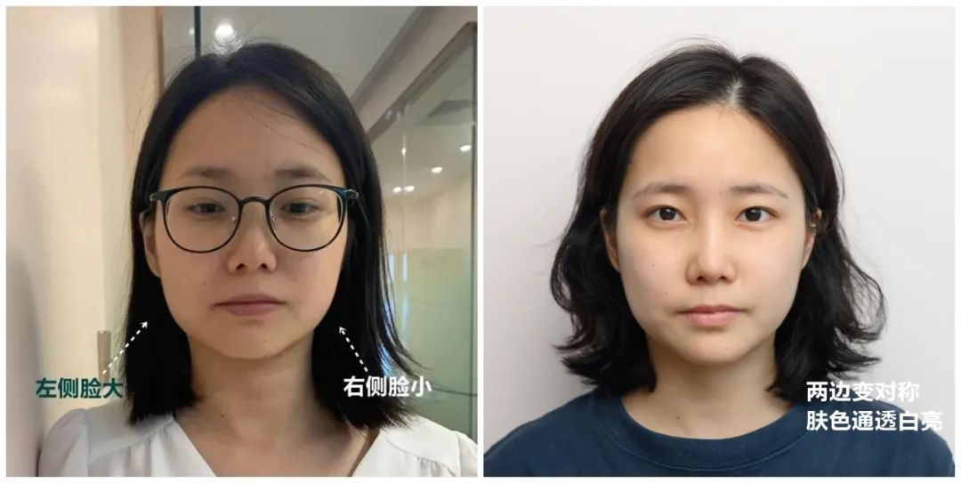 推广一个月没有任何效果,美容院脸部抗衰提拉紧致手法