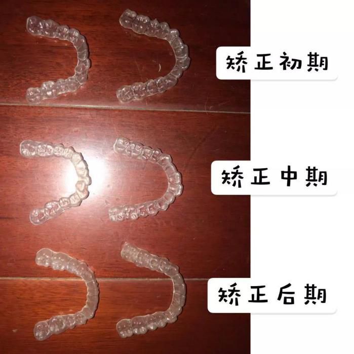 昆明独生子父母可以领补贴吗,昆明怎么领取补贴