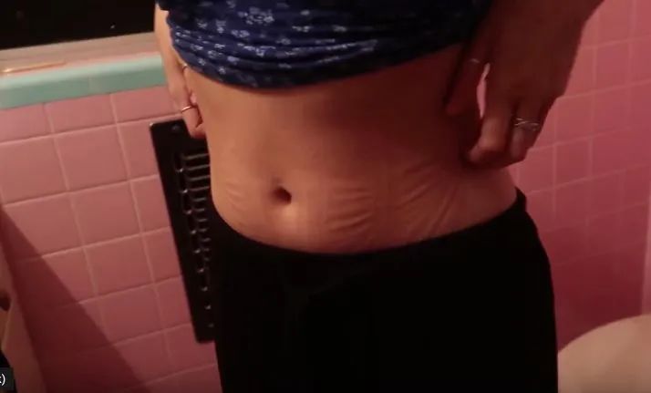 「网红束腰」：全世界有3亿人，在悄悄花钱买死