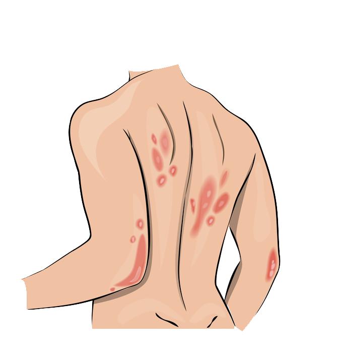 恋爱、结婚，想都不敢想…也有浙江小老板花100万治病：多少钱都行，快把我治好吧