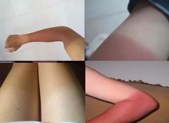 日本迷你口袋伞,日本口袋伞专治什么