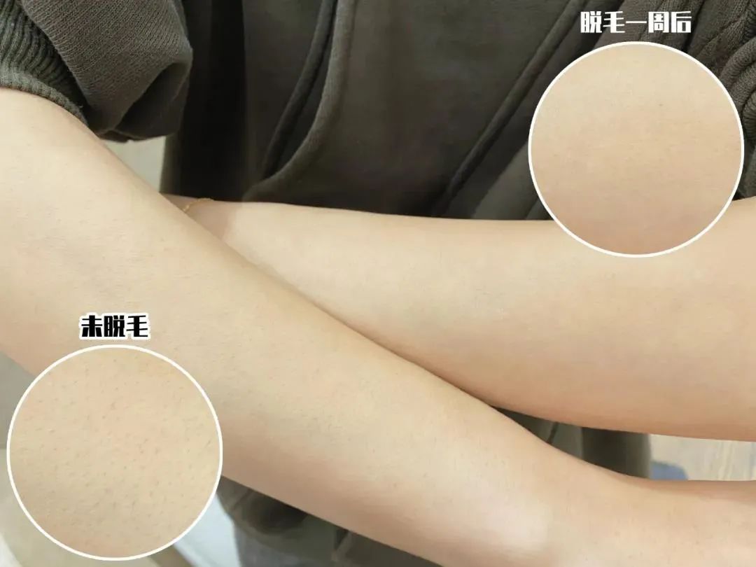 推广||我苦口婆心安利了三年，她们一用就说后悔没有早点买