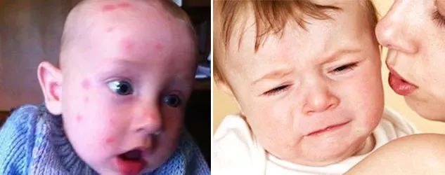 教你2分钟快速止痒,一小瓶止痒的药膏