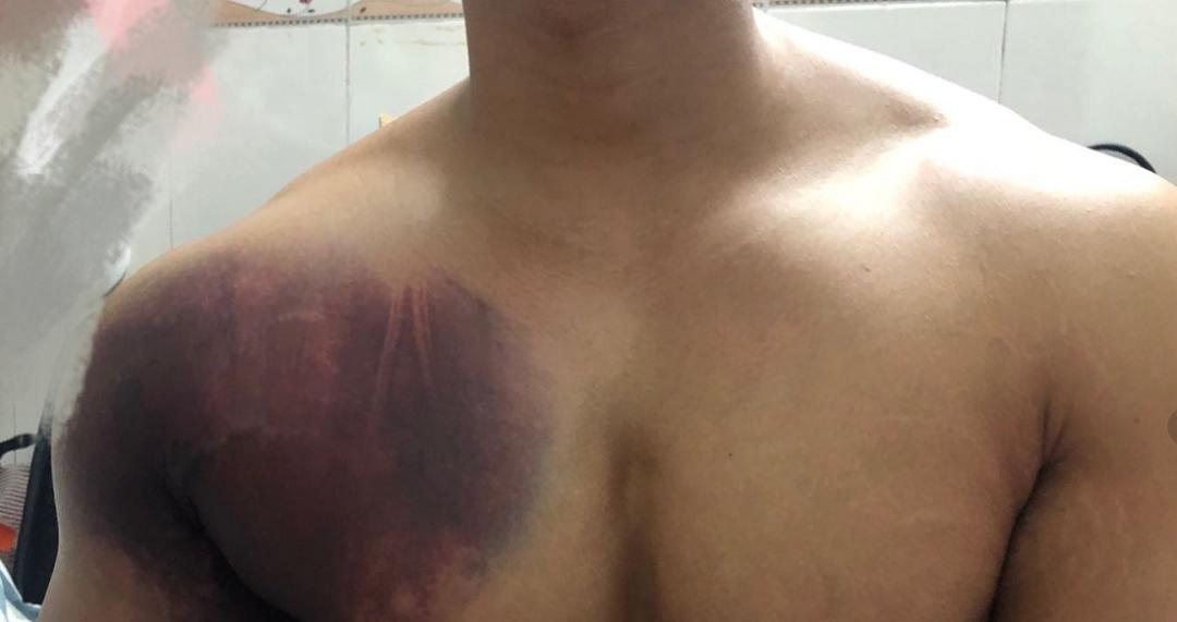 医院一天接诊三例猝死,警惕医院一天接诊119人又到高发季