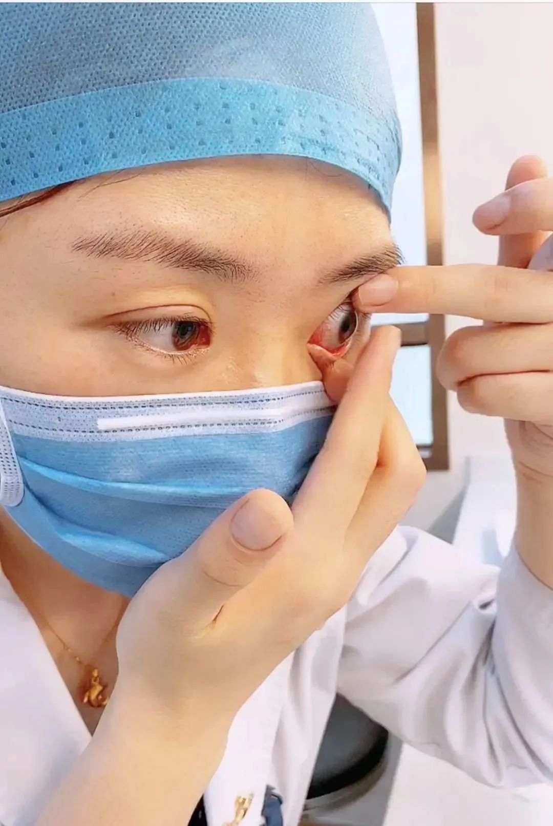 眼科医生能帮忙摘隐形眼镜吗,隐形眼镜可以徒手摘吗