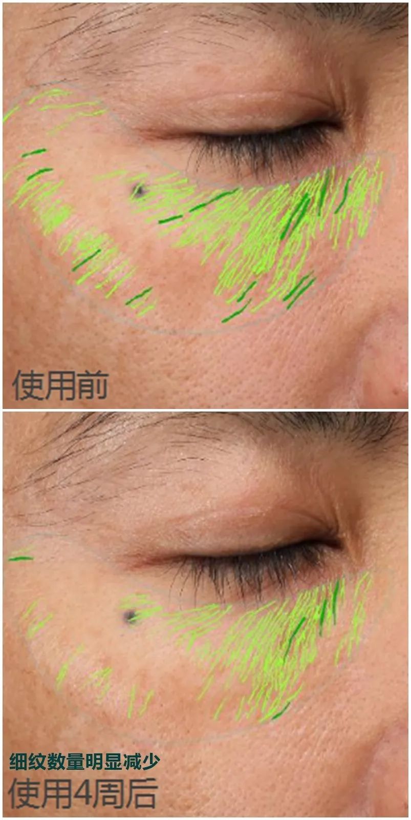 推广｜|啊啊啊，这些经常回购的东西终于打折了