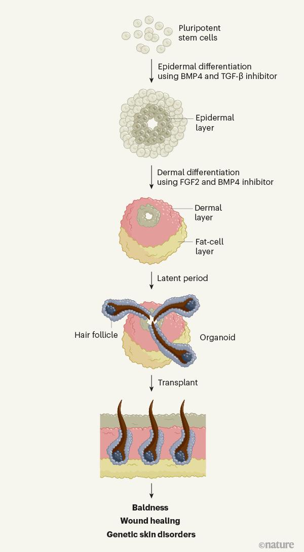 “聪明绝顶”有何惧？Nature研究迎来新突破，秃头有救了