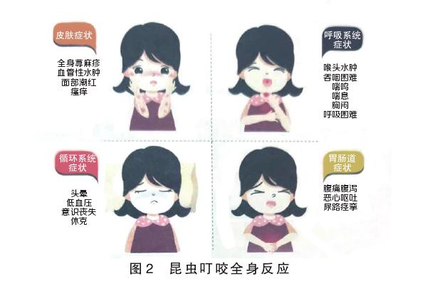 昆虫过敏是什么样子,昆虫咬过敏怎么治