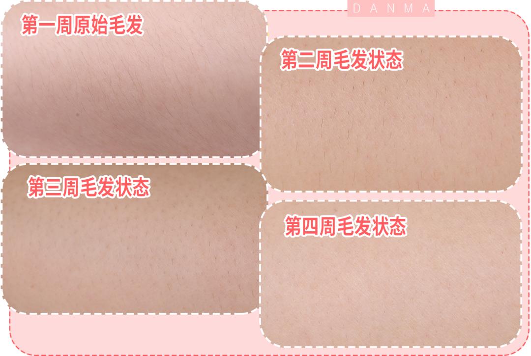 真实脱毛测评,官方测评真正有用的脱毛仪