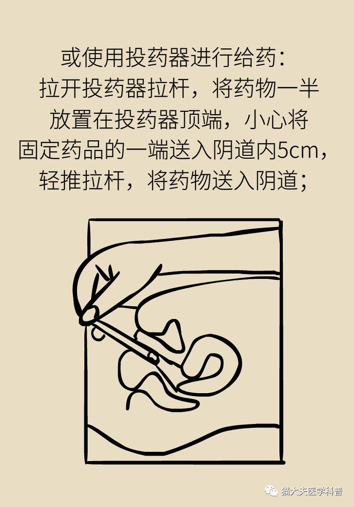 霉菌性阴道炎真的是里面“发霉”了吗？药师教你“抗霉”*法大**