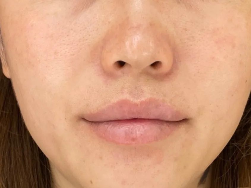 百人测评团|蒸笼天里，想让肌肤“一秒入水”，可能吗？