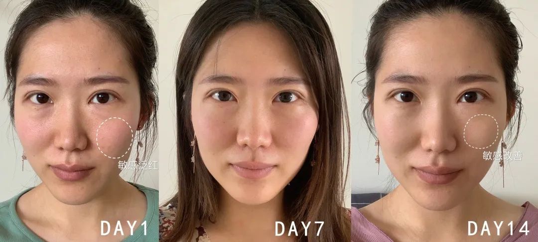 百人测评团|蒸笼天里,想让肌肤“一秒入水”,可能吗?