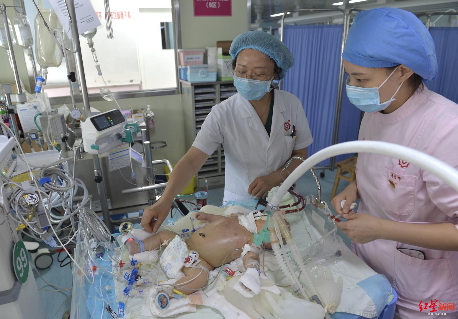 ecmo抢救新生儿,新生儿ecmo抢救无效纪录片