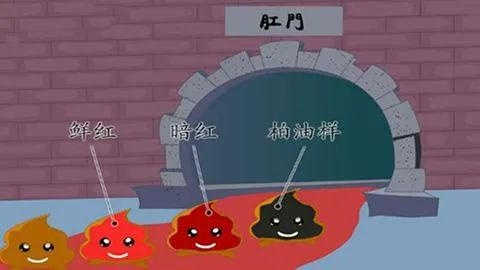 警惕！身体这7处“异常”出血，十有八九是“癌症”来袭