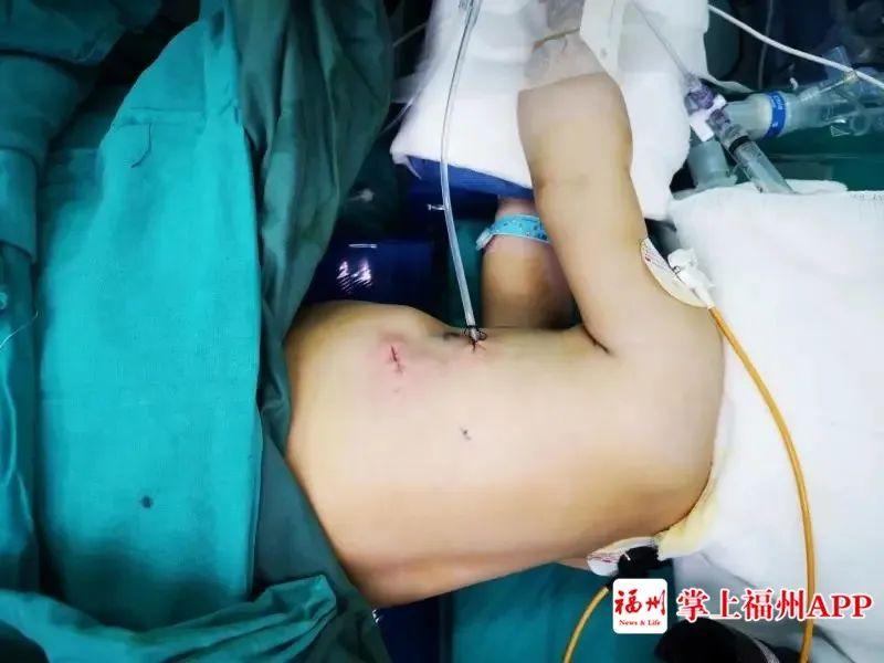 5个月宝宝咳嗽反复发烧38.5,8岁孩子反复发烧咳嗽厉害持续5天