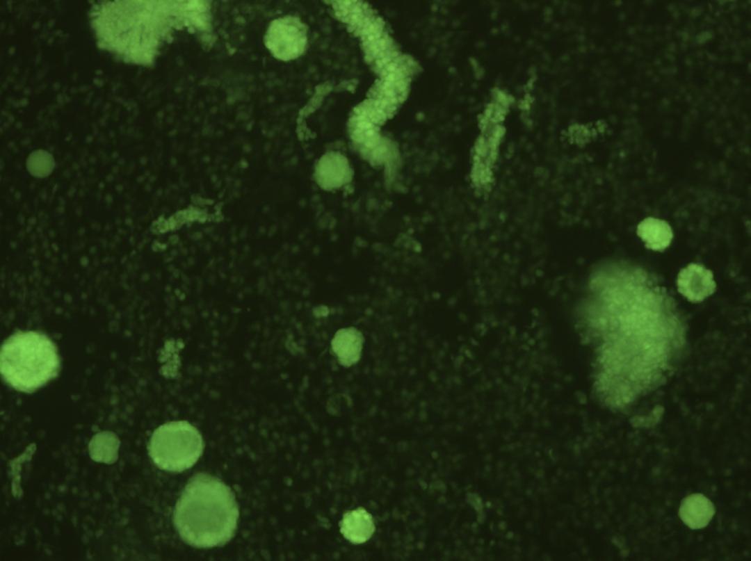 卵巢早衰延缓绝经,治卵巢早衰最新科研技术