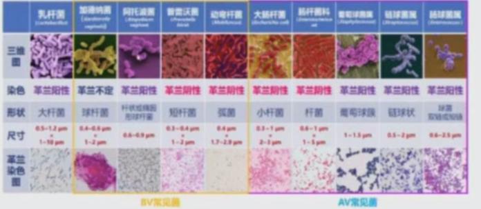 阴道这个江湖,乱了就麻烦了