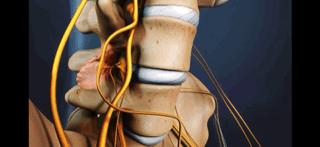 腰痛来龙去脉,腰疼真相