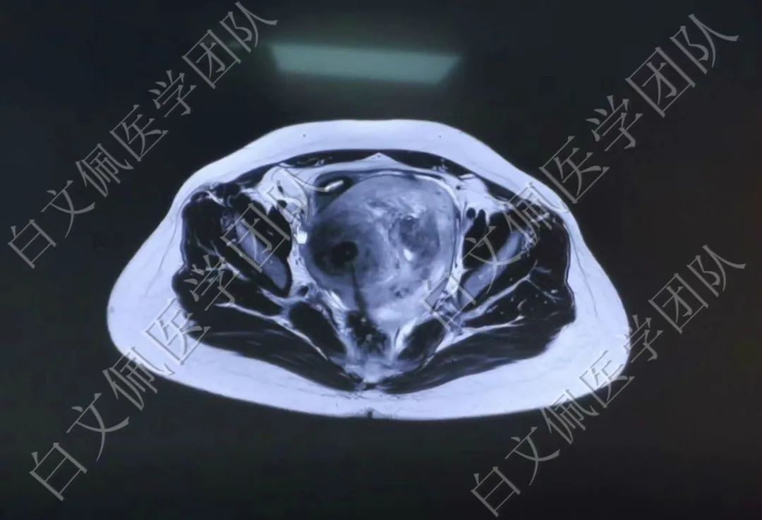 盆腔肌肉解剖结构示意图,盆腔解剖6个位置图