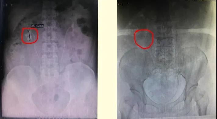 绵阳市第四人民医院科室,绵阳市江油市第四人民医院