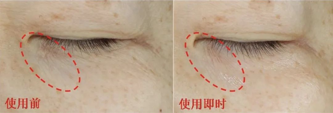 空瓶眼霜回购,无限回购的一款国货眼霜