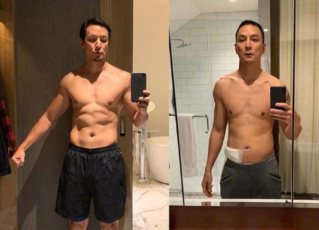 吴彦祖治疗阑尾炎视频,吴彦祖微博自曝曾因阑尾炎险丧命