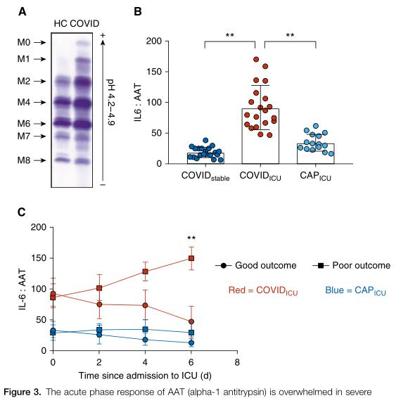 严重COVID-19疾病的炎症反应有哪些特征？｜前沿速递