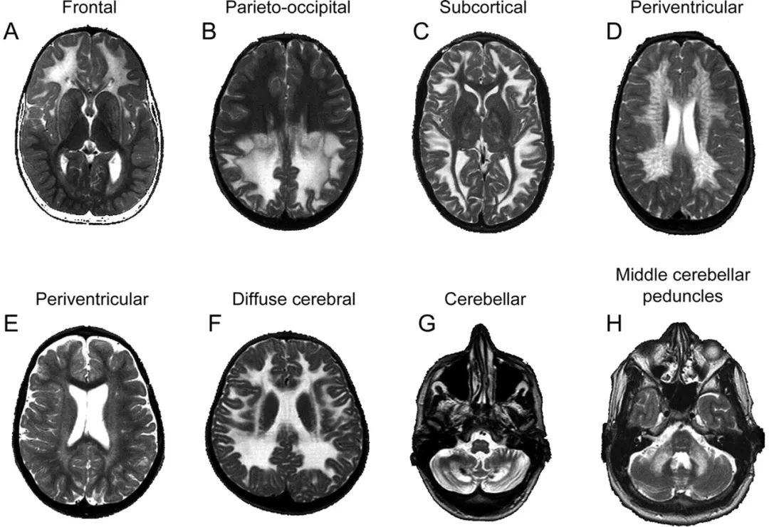 徐运神经内科,徐运医生怎么样
