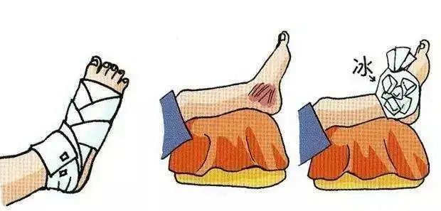 眼睛冰敷还是热敷,什么时候冰敷最好