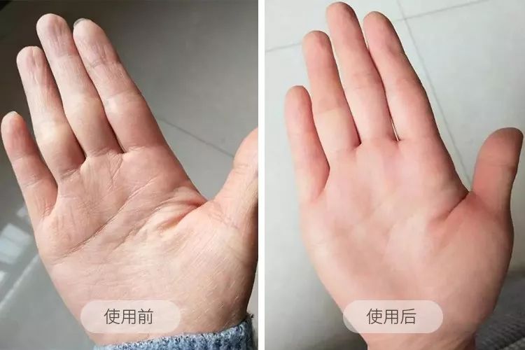 你穿高跟鞋经历过磨脚的痛苦吗,穿高跟鞋脚掌死皮怎么去除