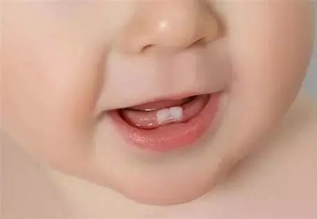 孩子经常刷牙为什么还会蛀牙,天天刷牙怎么还蛀牙