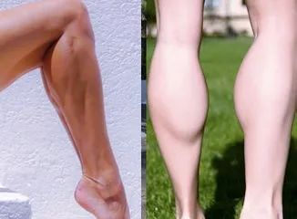 日本4分钟变态减肥法,腿部抽脂大象腿真实案例