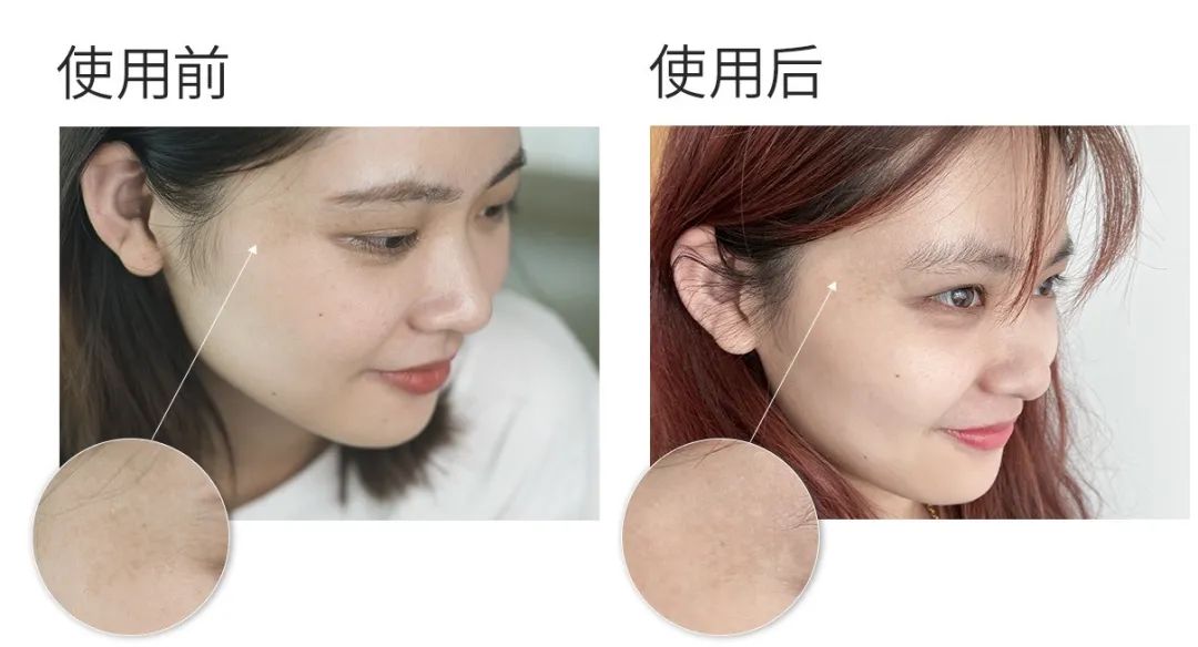 推荐一下你们用过的最好的祛斑霜,公认十大最好的祛斑霜