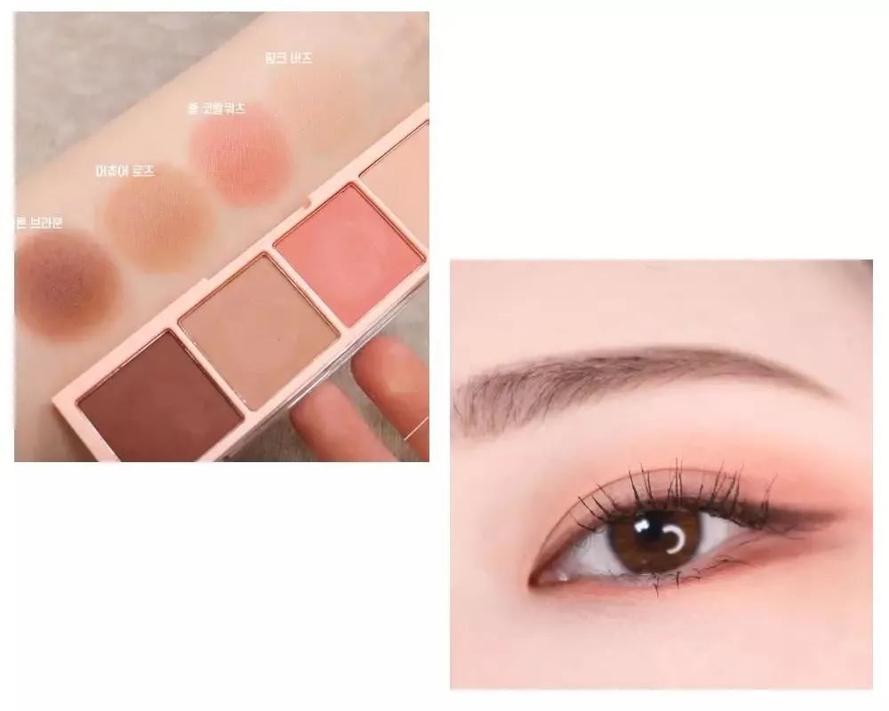 眼综合包含在眼综合吗,眼综合每个人都适合吗