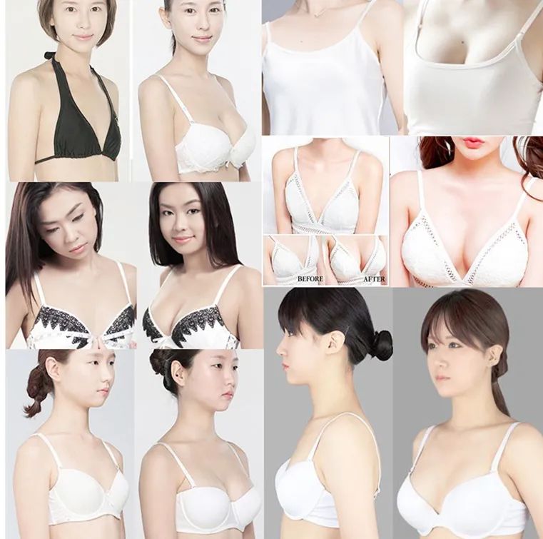 有什么方法可以丰胸不用丰胸产品,其实丰胸很简单呀