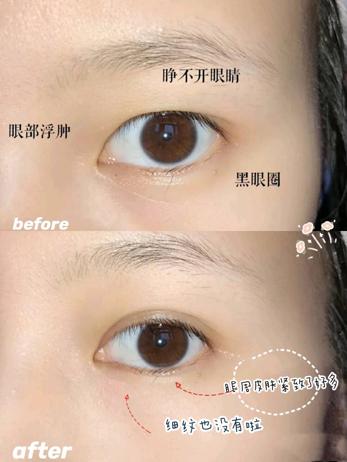 欧阳娜娜关晓彤眼霜,欧阳娜娜眼霜去黑眼圈