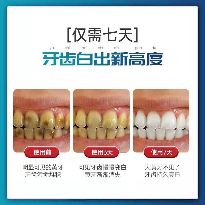 牙黄牙黑被嫌弃网红牙贴,美白牙贴真的能拯救懒人的黄牙吗