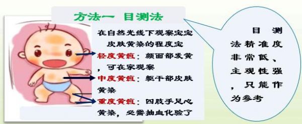刚出生的宝宝黄疸怎么预防,新生宝宝为什么容易出现黄疸