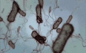 上厕所用湿纸巾擦有什么好处,上完厕所有纸巾正确擦法