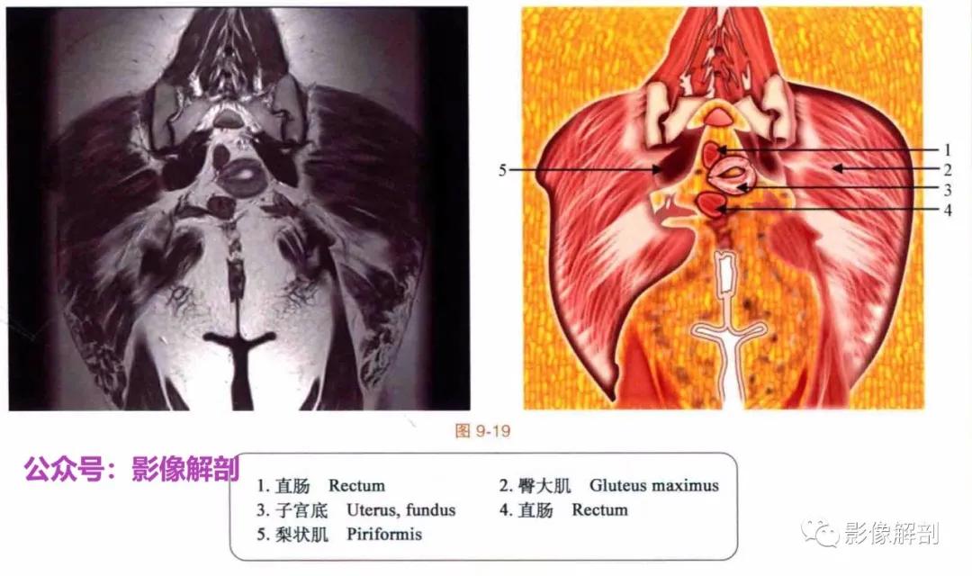 女性盆腔矢状位断层解剖,男性盆腔磁共振断层图谱