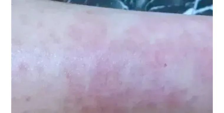 j-style冰点脱毛仪,j-style光子嫩肤脱毛仪