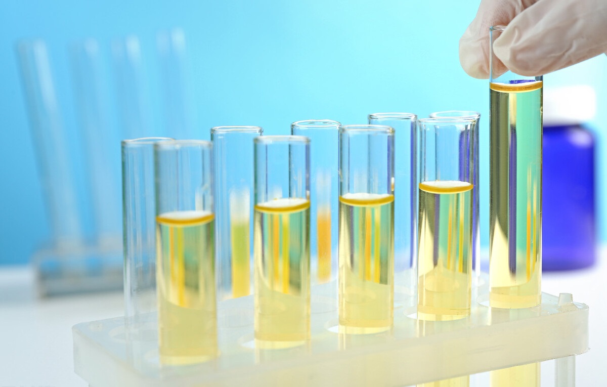 尿隐血有加号红细胞高怎么回事,尿隐血一定是肾出问题了吗