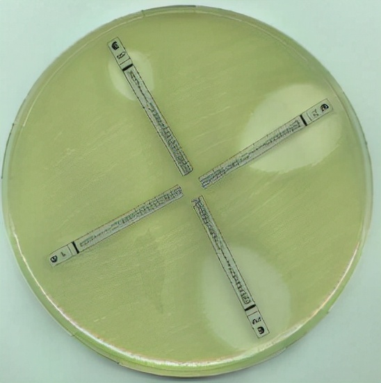 药敏是查什么的,药敏报告是怎么检查