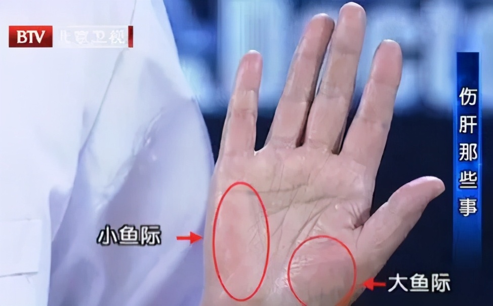 中医体内湿气太重怎么祛除,中医认为湿气重的人怎么调理