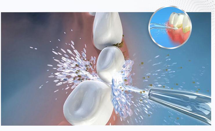 冲牙器台式和便携式哪种好,便携式冲牙器真实评测推荐第一名