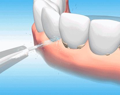 看糖尿病患者拿什么礼物合适,送糖尿病长辈什么食品礼物最合适