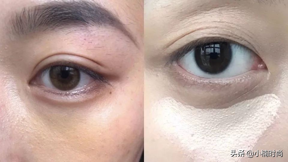 黑眼圈泪沟遮瑕手法,黑眼圈泪沟法令纹遮瑕教程来了