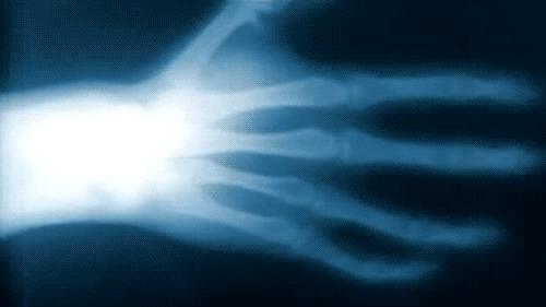 什么是X射线，它是如何被发现的，对人类有多大影响？