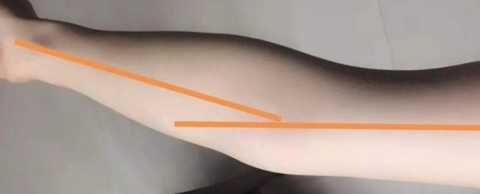 肱二头肌短头怎么练饱满,手臂太细了怎么练粗肱二头肌