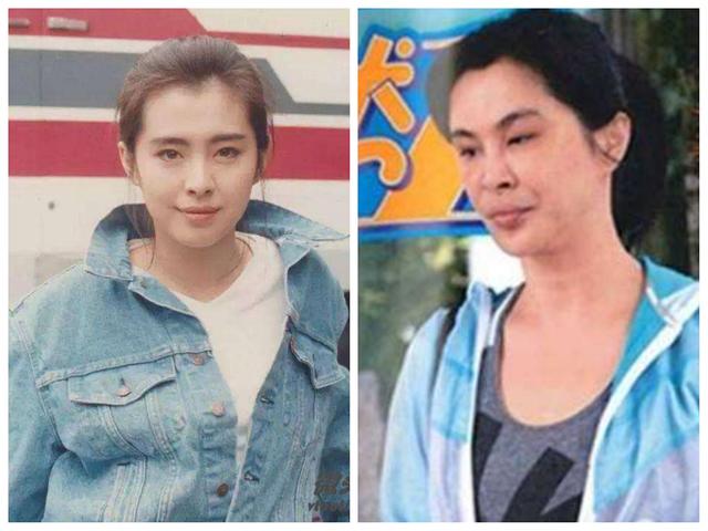 经常打玻尿酸10年后会有什么变化,连打几次玻尿酸就会持久呢